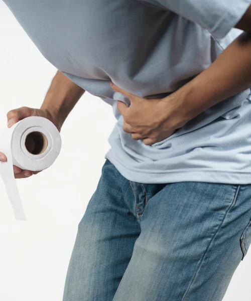 Cirugía de hemorroides en Guadalajara con el Dr. Diego Acevedo